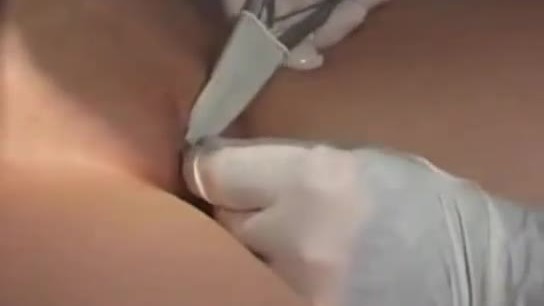 Vagina piercing